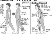 腰痛対策の歩き方改革　「東大式ウォーキング」やってみた