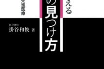 【山内昌之氏書評】5mm以下の癌も　名医が明かす病気発見術