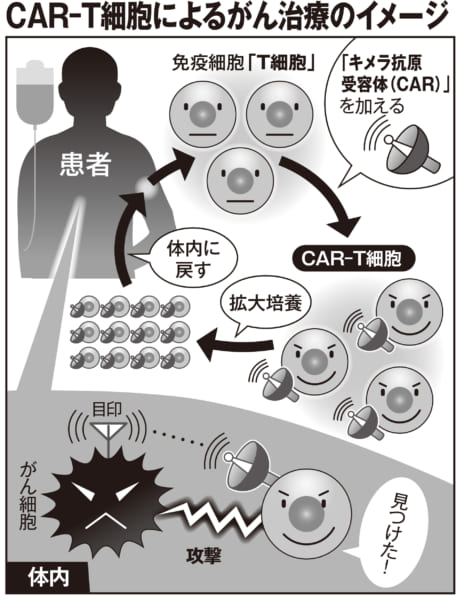 CAR-T細胞によるがん治療のイメージ