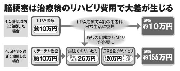 写真 脳梗塞治療の境目は発症4時間半以内 治療費に大差発生 Newsポストセブン Part 2