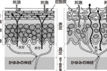 高齢者にはスキンケアが必要　湿度が高い夏でも保湿が重要