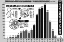 【表】帯状疱疹は50代から発症リスクが急増