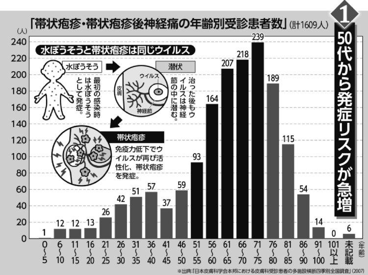 【表】帯状疱疹は50代から発症リスクが急増