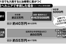 鼠径ヘルニア他、「日帰り手術」で治療費はいくら減らせるか