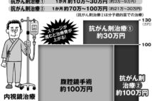 医療費高いがん手術　「保険適用外」を選ぶメリット・デメリット