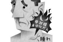 甲状腺がんの悪性「未分化がん」の特徴は？（イラスト／いかわ やすとし）