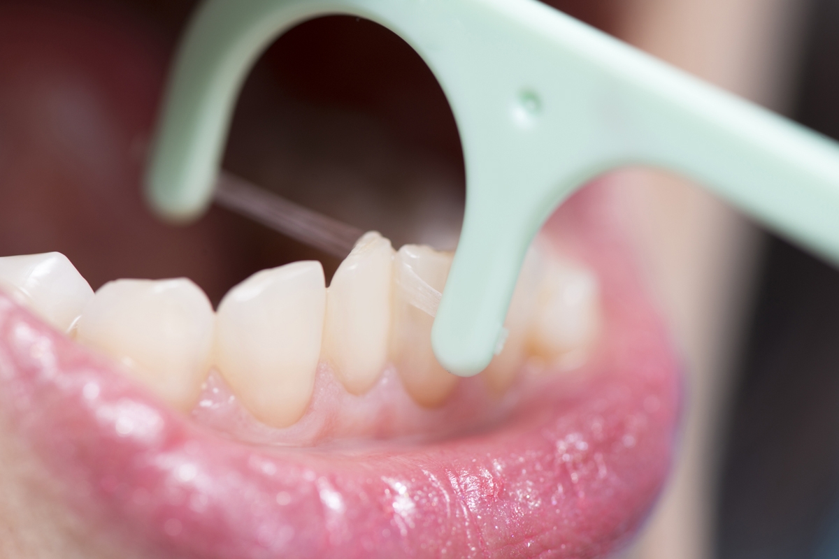 歯科医が教える 歯周病を予防する歯磨き 歯間ブラシの併用も Newsポストセブン