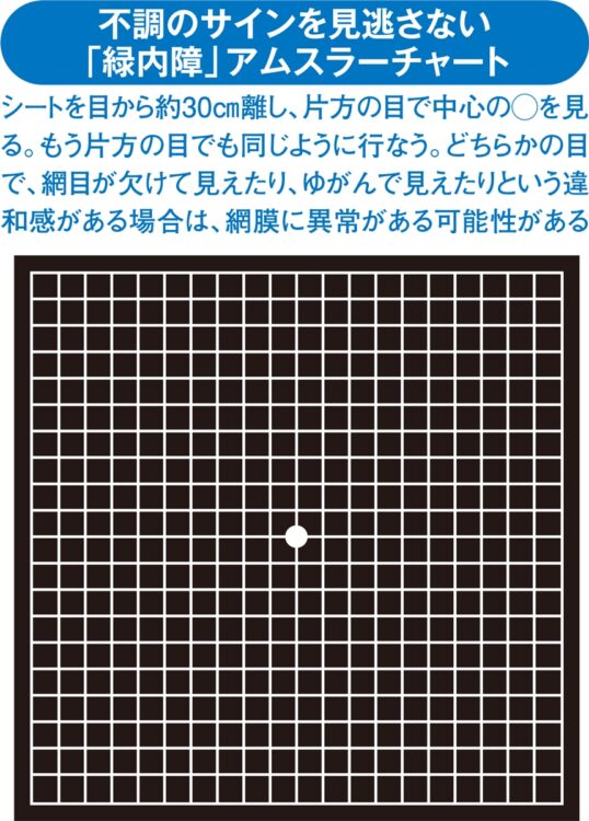 「緑内障」アムスラーチャート