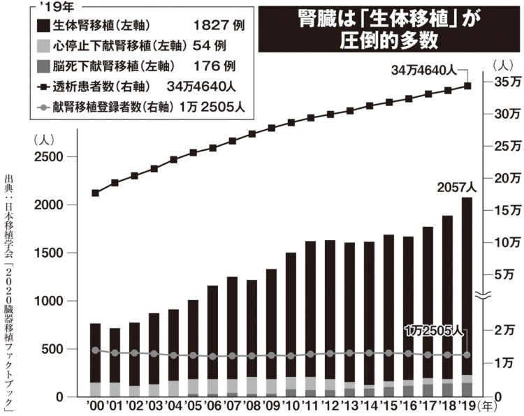 腎臓は生体移植が多い