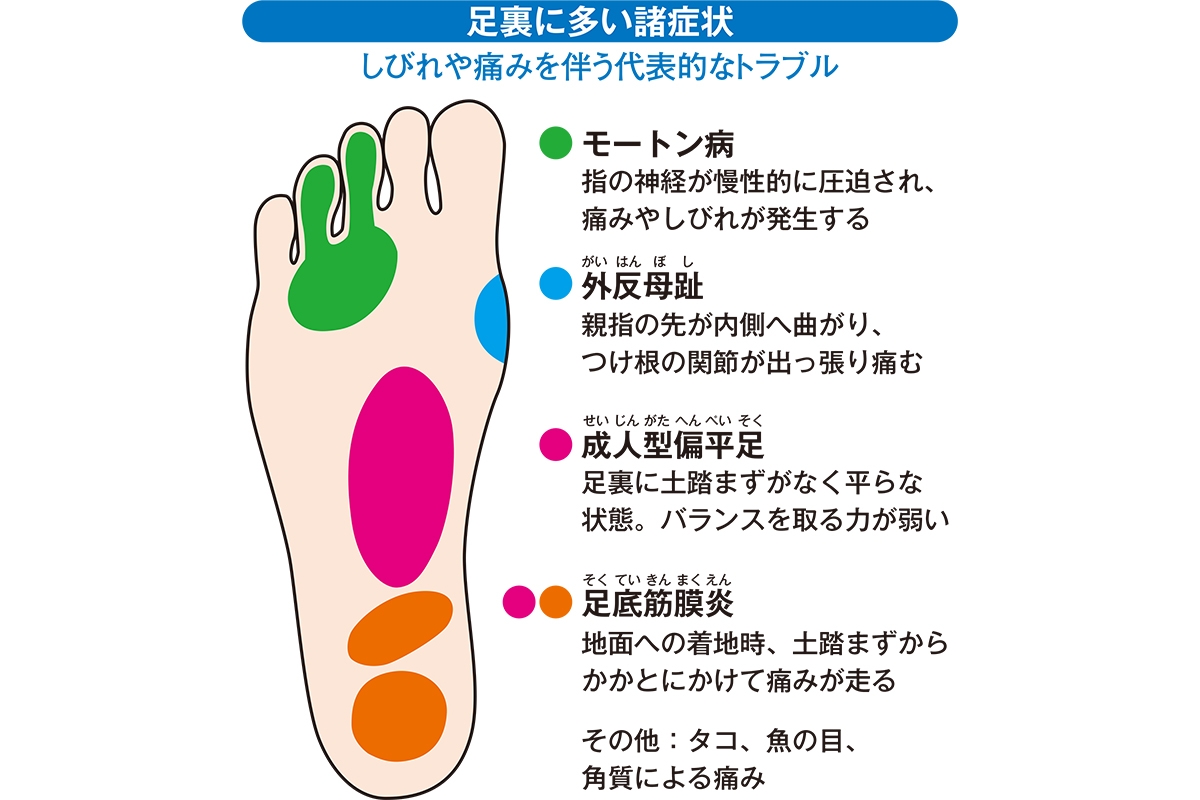 足裏の痛み しびれを消してラクに歩く 足裏寿命を延ばす筋トレ マッサージ Newsポストセブン