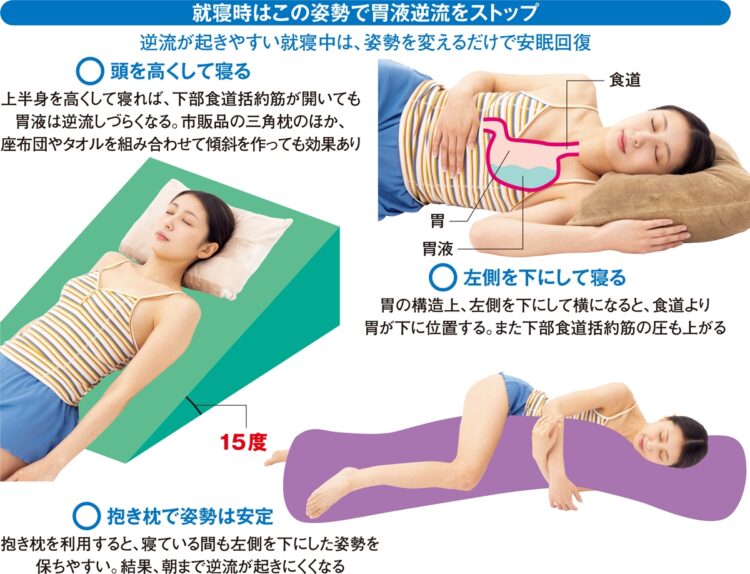 就寝時はこの姿勢で胃液逆流をストップ