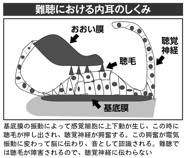 難聴における内耳のしくみ