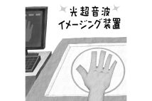 「光超音波イメージング装置」の仕組みとは（イラスト／いかわやすとし）