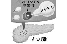 神経内分泌腫瘍はどう治療する？（イラスト／いかわやすとし）