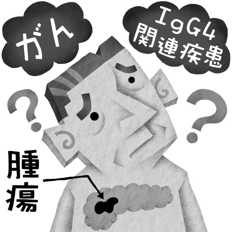 IgG4関連疾患とは？（イラスト／いかわやすとし）