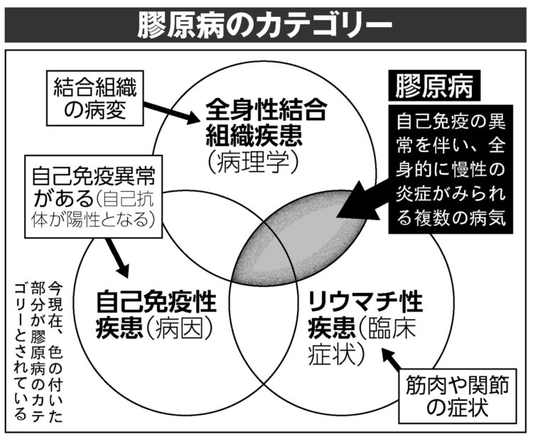 膠原病のカテゴリー