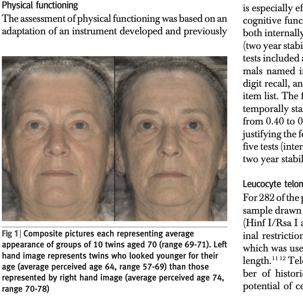 双子でも老けて見えるほうが死亡リスクは高いという（デンマーク双生児登録・老化研究センターのKaare Christensen氏らの論文より。※2）