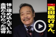 【動画】西田敏行さん、体に埋め込んでいた金属だらけだった遺骨